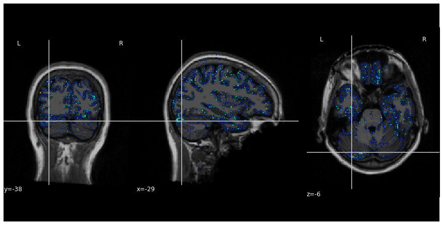 Get brain tissue parcellation using kwyk model — Nobrainer Book